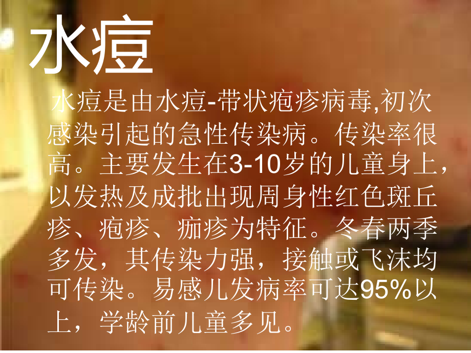 秋季水痘疫苗预防知识.ppt_第2页