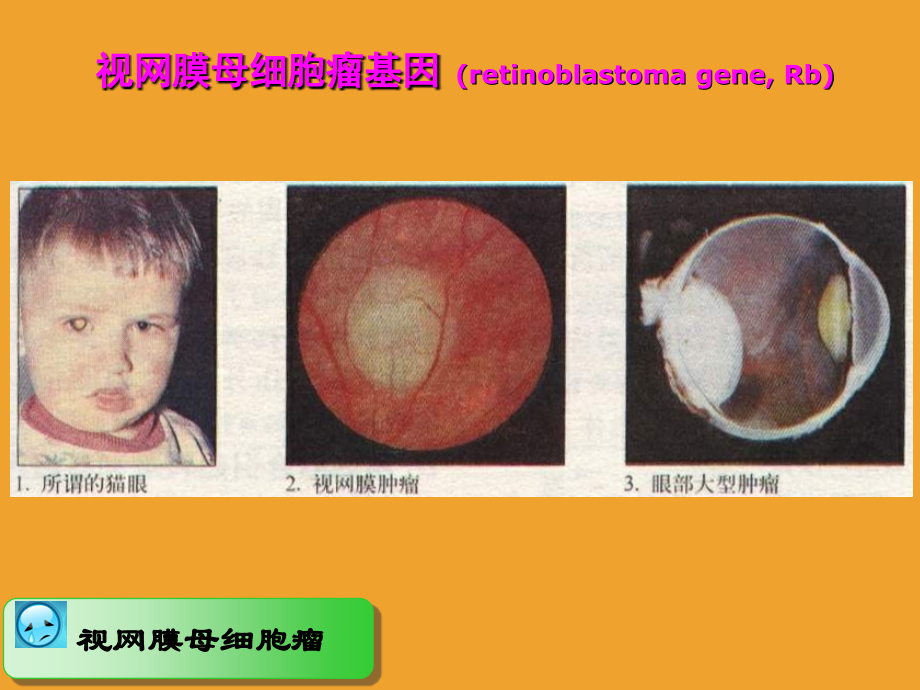 端粒与肿瘤1.ppt_第2页