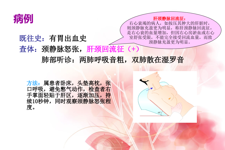 慢性心功能不全.ppt_第2页