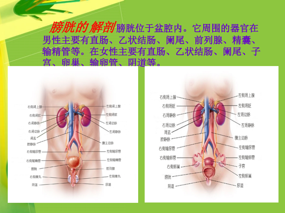回肠代膀胱手术配合.pptx_第2页