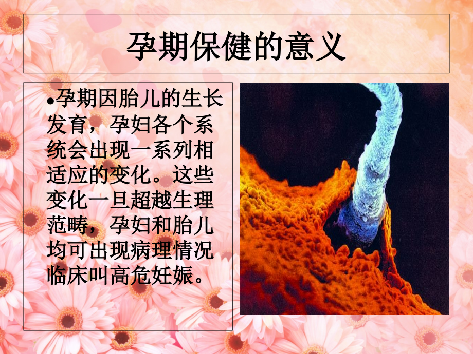 孕期保健知识(77).ppt_第2页