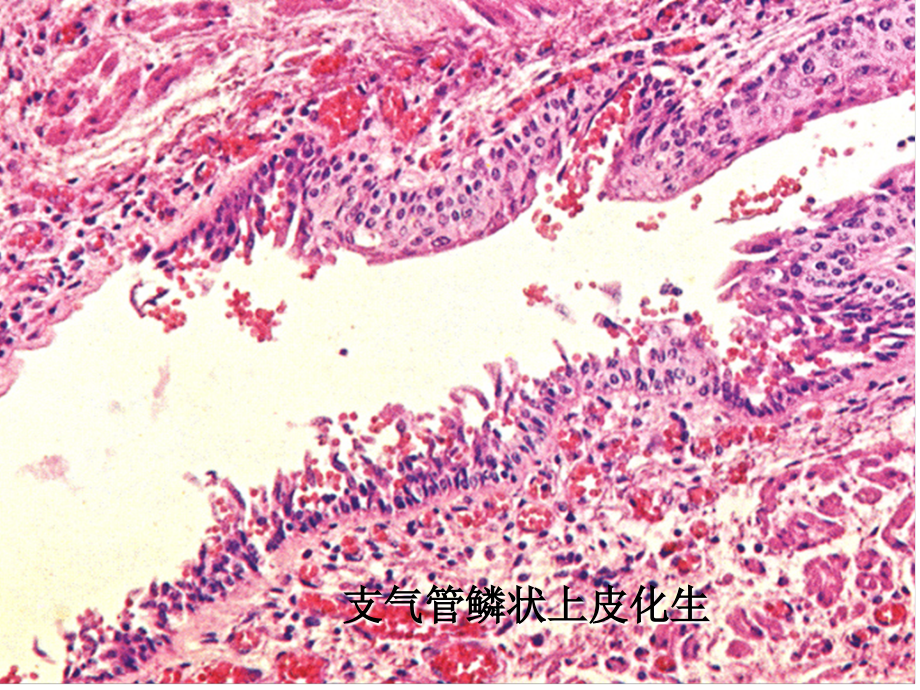 病理图片考试图片库(解注版).ppt_第2页