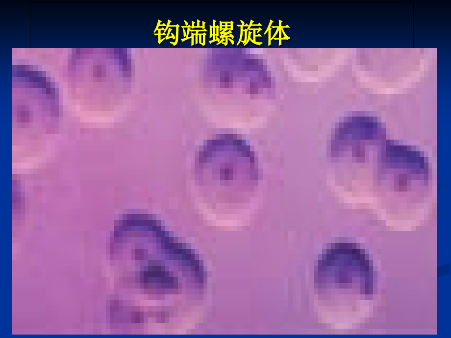 支原体衣原体螺旋体.ppt_第2页