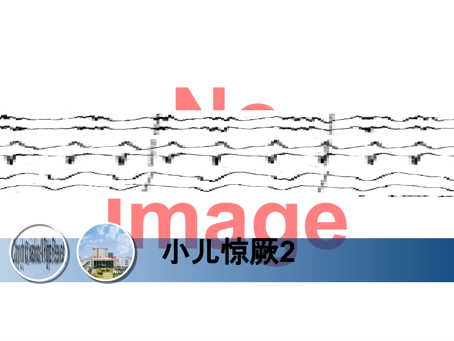 小儿惊厥2.ppt_第1页