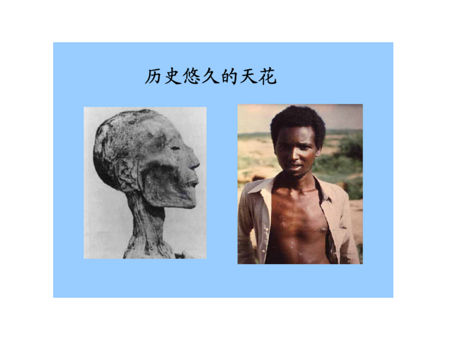 病毒概述1.ppt_第1页