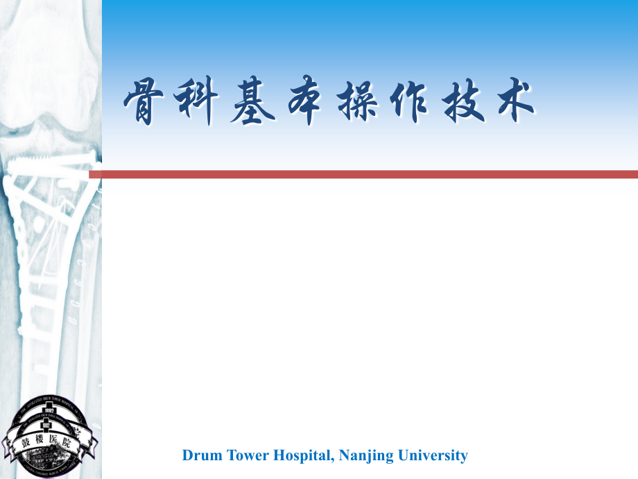 石膏牵引--鼓楼医院.ppt_第1页