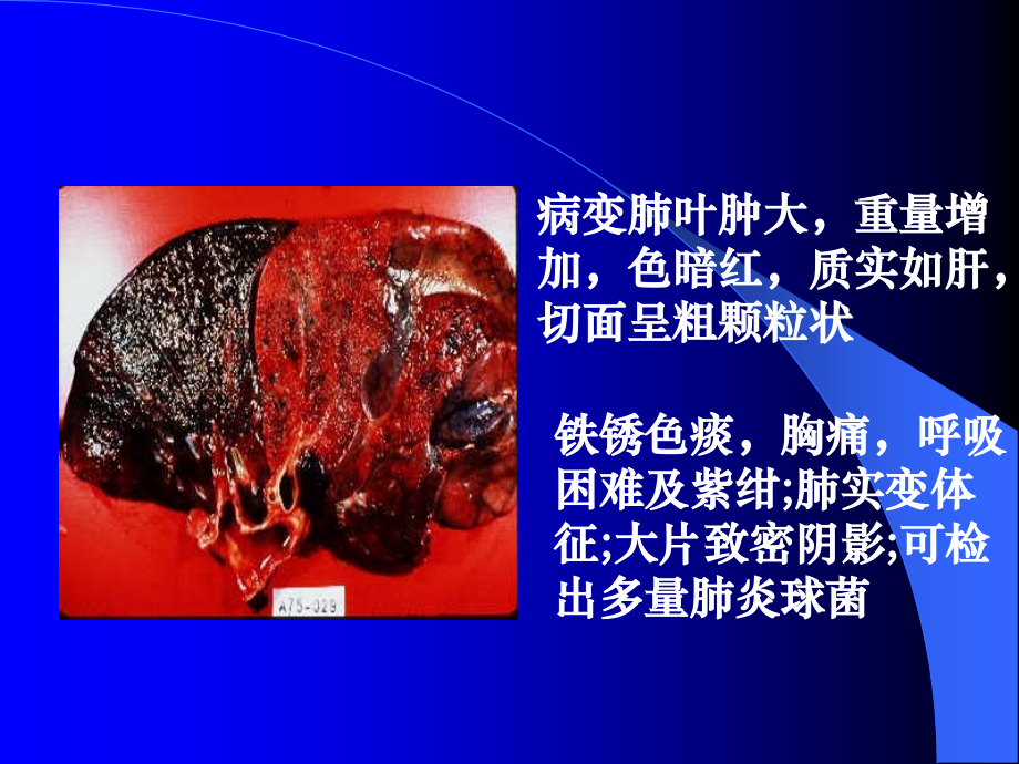 第七章-呼吸系统疾病(七年制).ppt_第2页