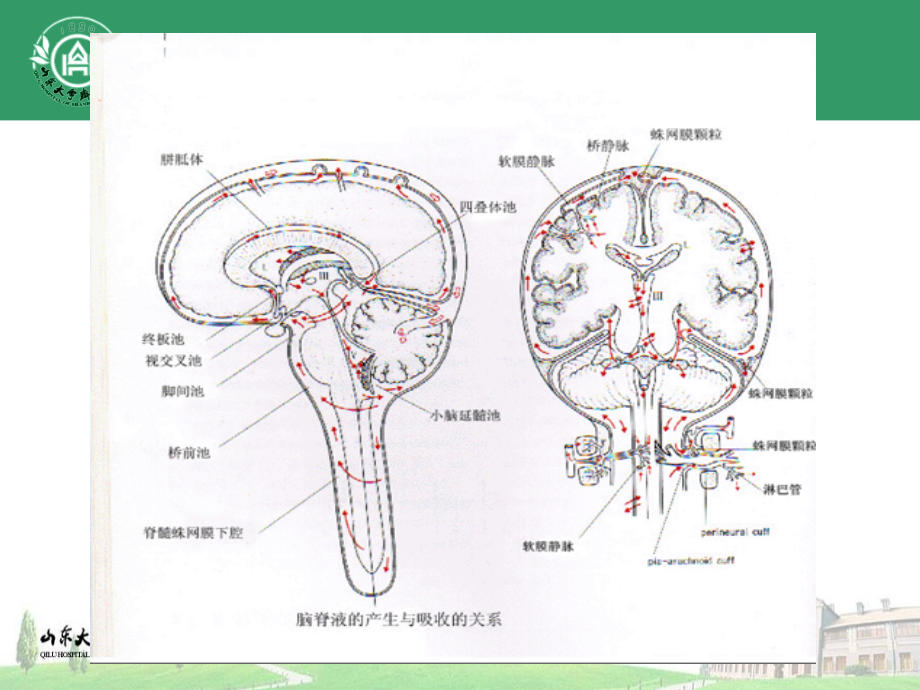 脑积水诊断与治疗-江玉泉.ppt_第2页