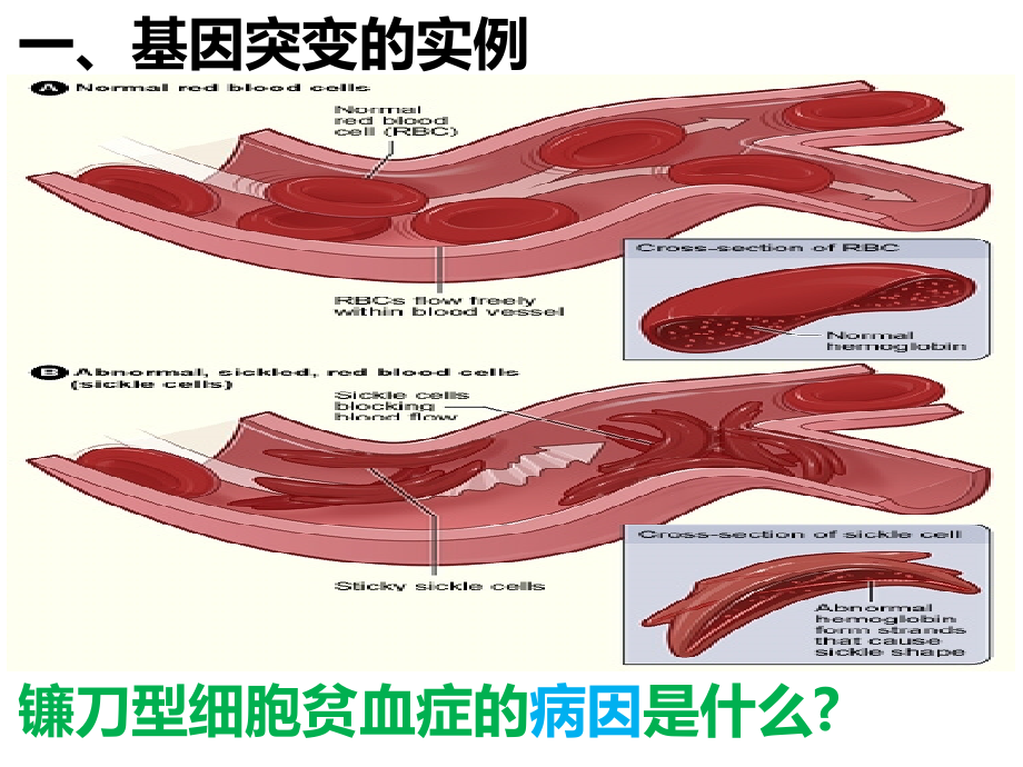 《基因突变和基因重》.ppt_第1页