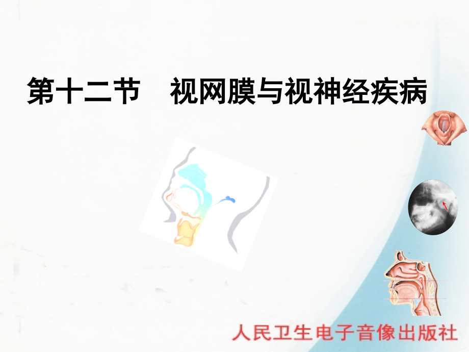 第十二节-视网膜和视神经疾病.ppt_第1页