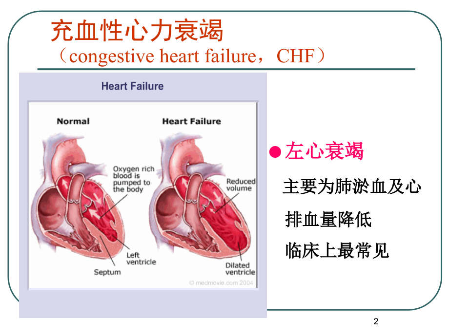 第18章-抗慢性心功能不全药.ppt_第2页