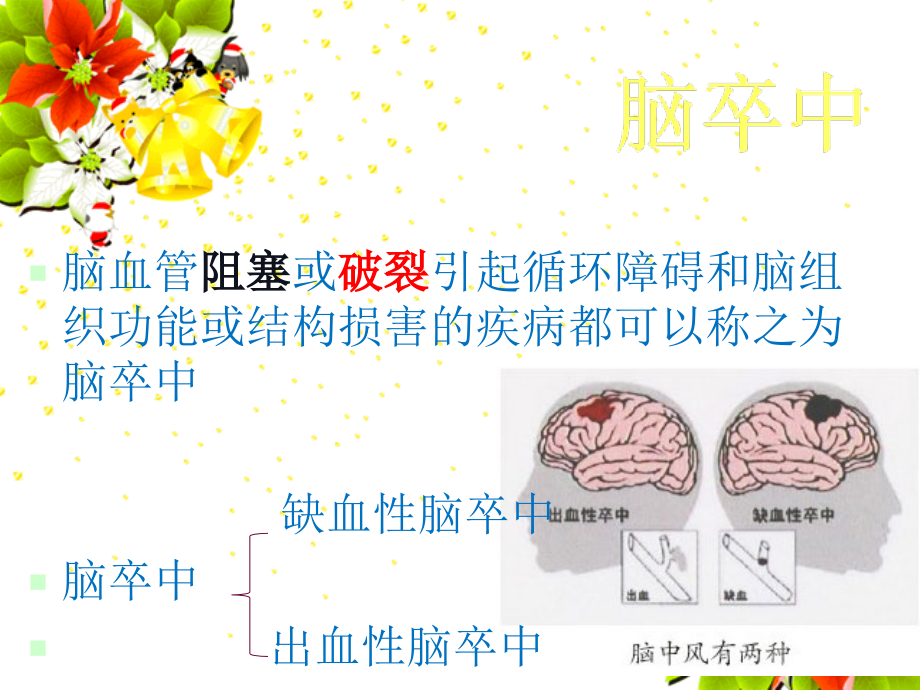 社区脑卒中健康教育幻灯片.ppt_第2页