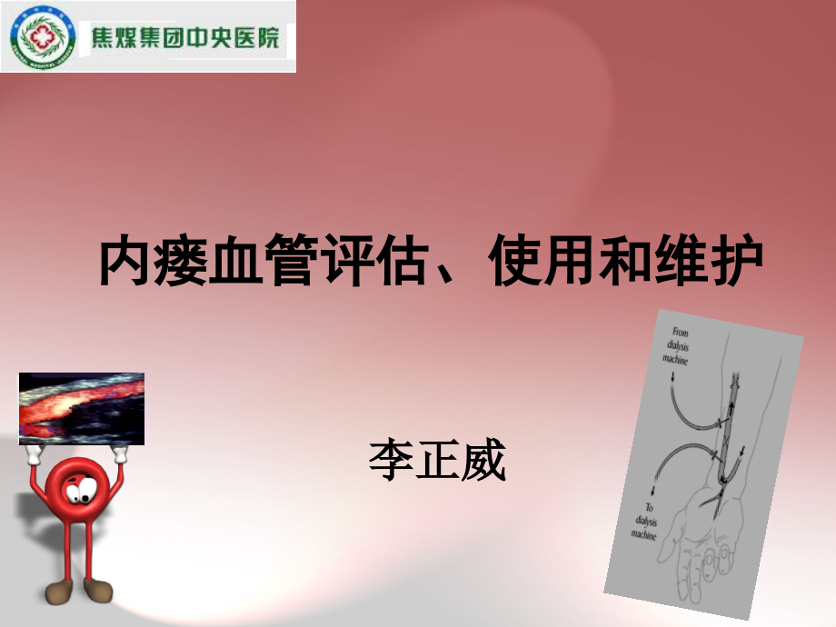 李正威内瘘血管评估、使用和维护-.ppt_第1页