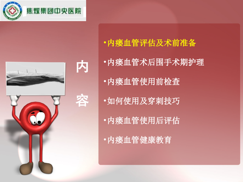 李正威内瘘血管评估、使用和维护-.ppt_第2页