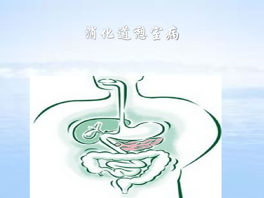 消化道憩室病.pptx_第1页