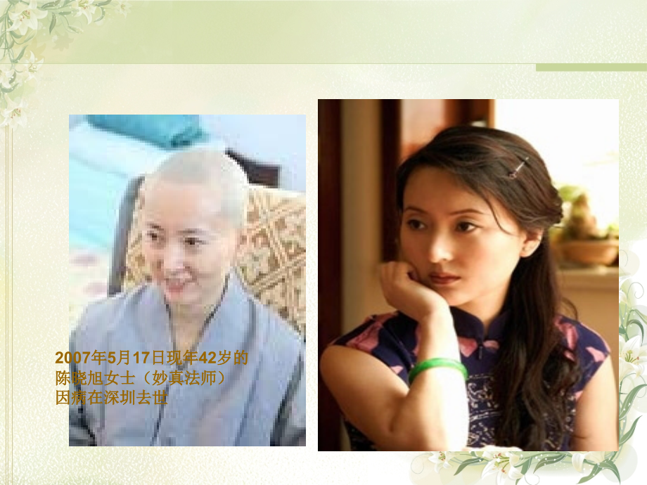 普外一科乳腺癌模拟查房.ppt_第2页