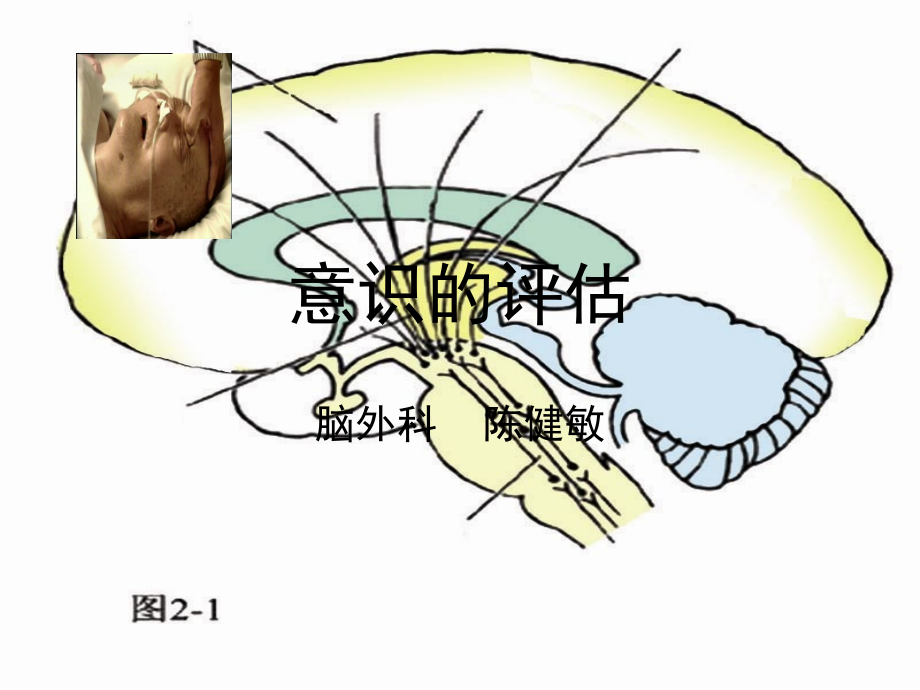 意识评估.ppt_第1页
