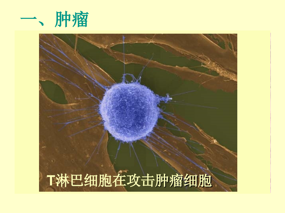 新亚洲-6.3.4非传染性疾病.ppt_第2页