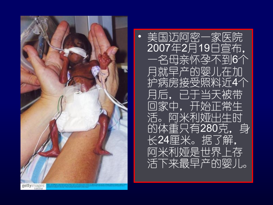 抗早产Guideline[1]演示稿.ppt_第1页