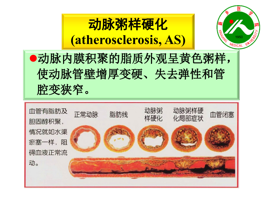 新医课件-调血脂药与抗动脉粥样硬化药1学时.ppt_第2页
