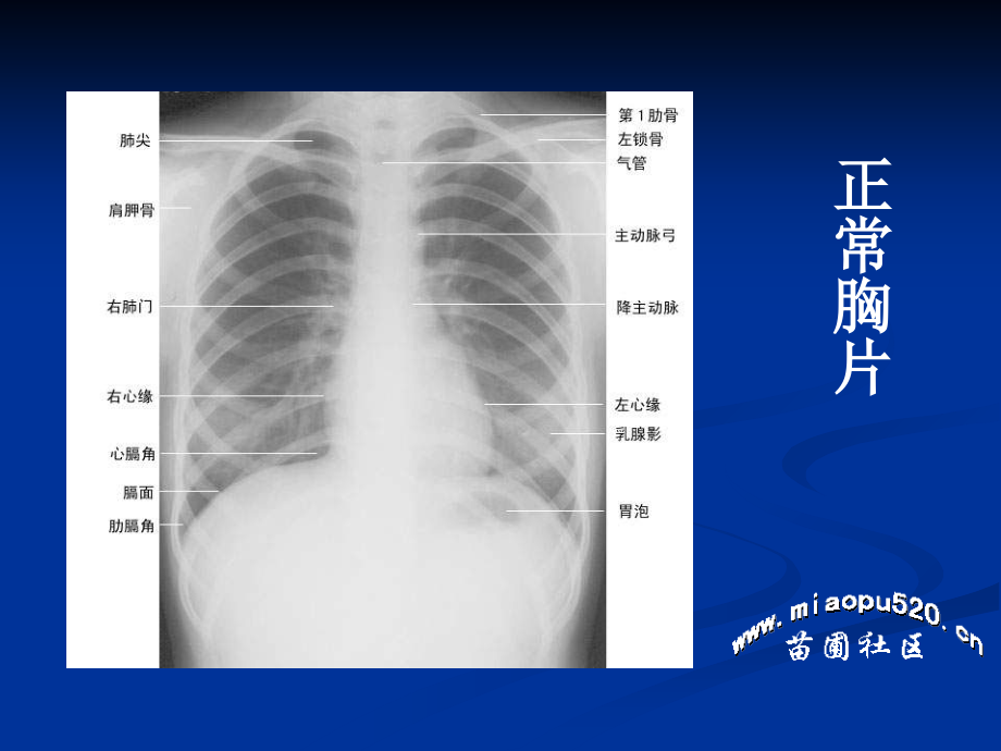 执业医师考试X线培训.ppt_第1页