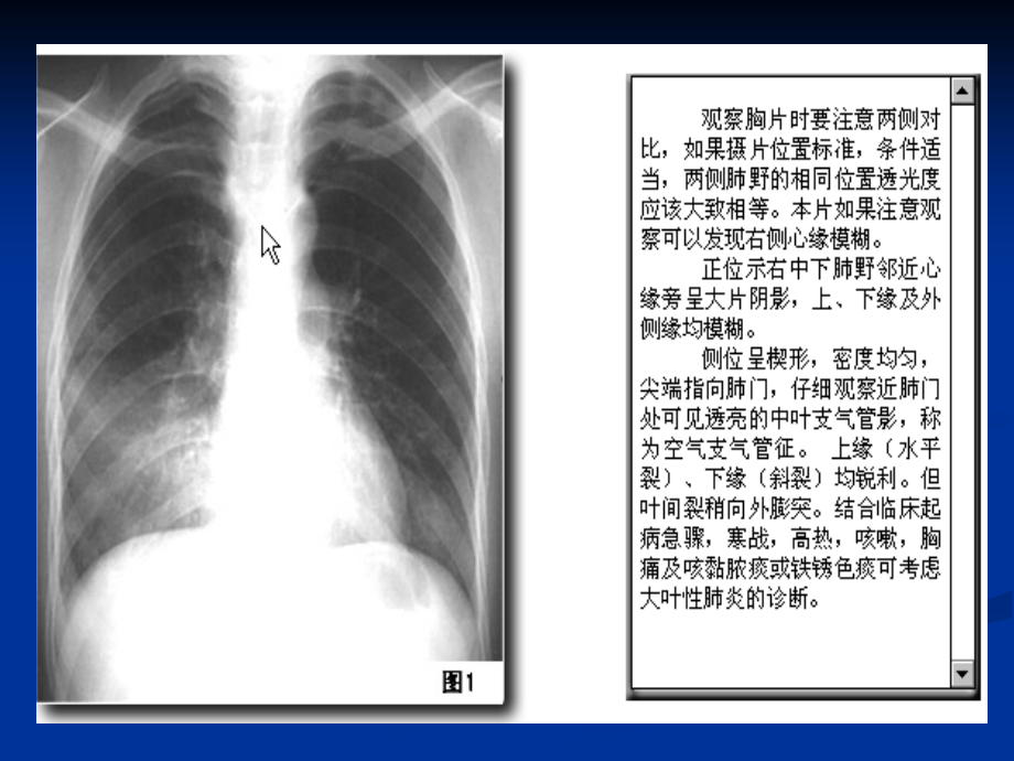 执业医师考试X线培训.ppt_第2页