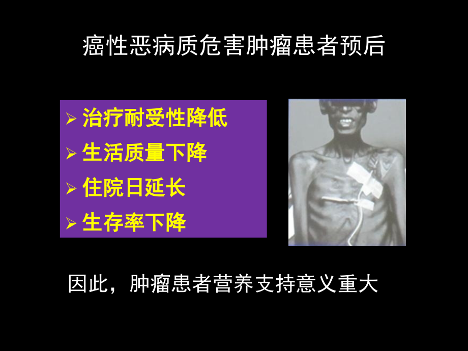 恶性肿瘤的营养支持治疗-final.ppt_第2页