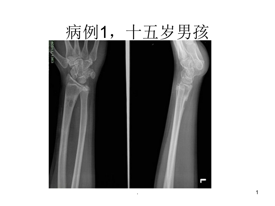 科内讲课.ppt_第1页