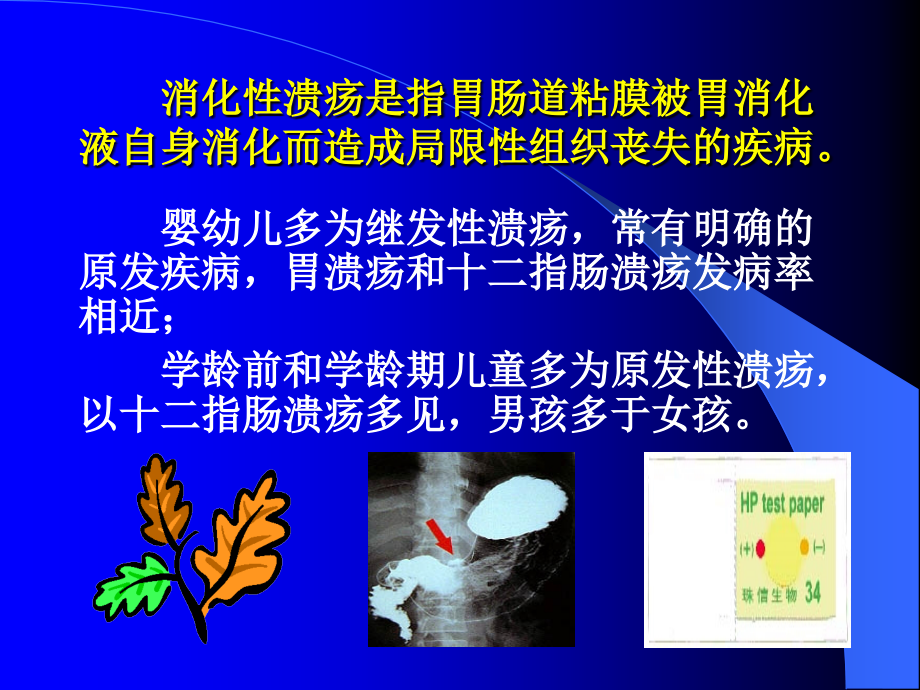 小儿消化性溃疡诊治.ppt_第2页