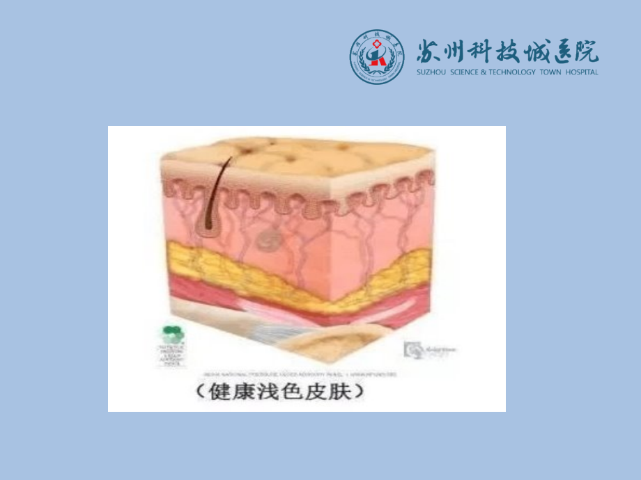 伤口敷料的选择及应用.ppt_第2页