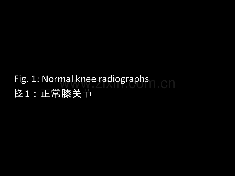 医学髌骨病变的影像学表现.ppt_第2页