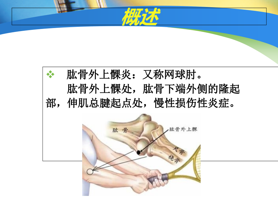 医学课件针刀治疗肱骨外上髁炎思路探讨.ppt_第2页
