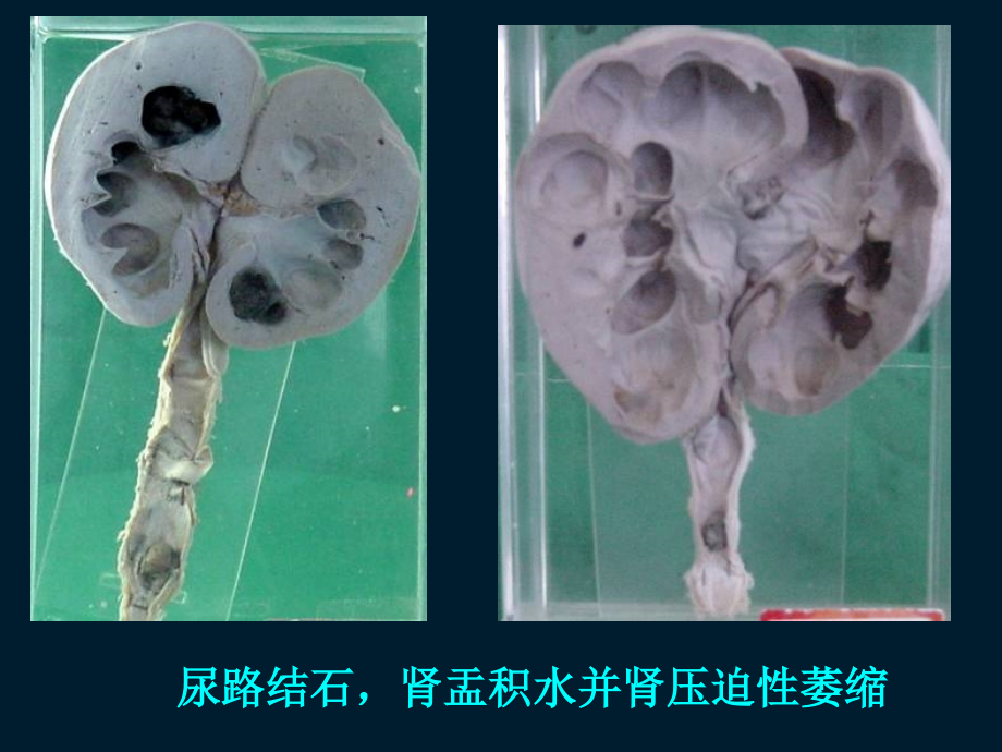 实习课-大体标本复习(医学PPT课件).ppt_第2页