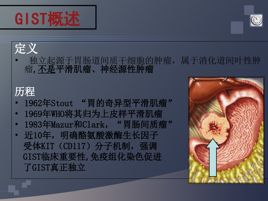 医学胃肠间质瘤研究.ppt_第2页