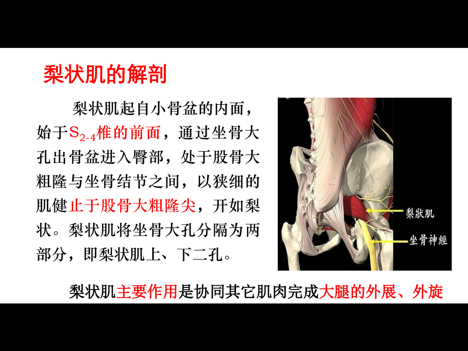 梨状肌综合征的影像诊疗课件.ppt_第2页