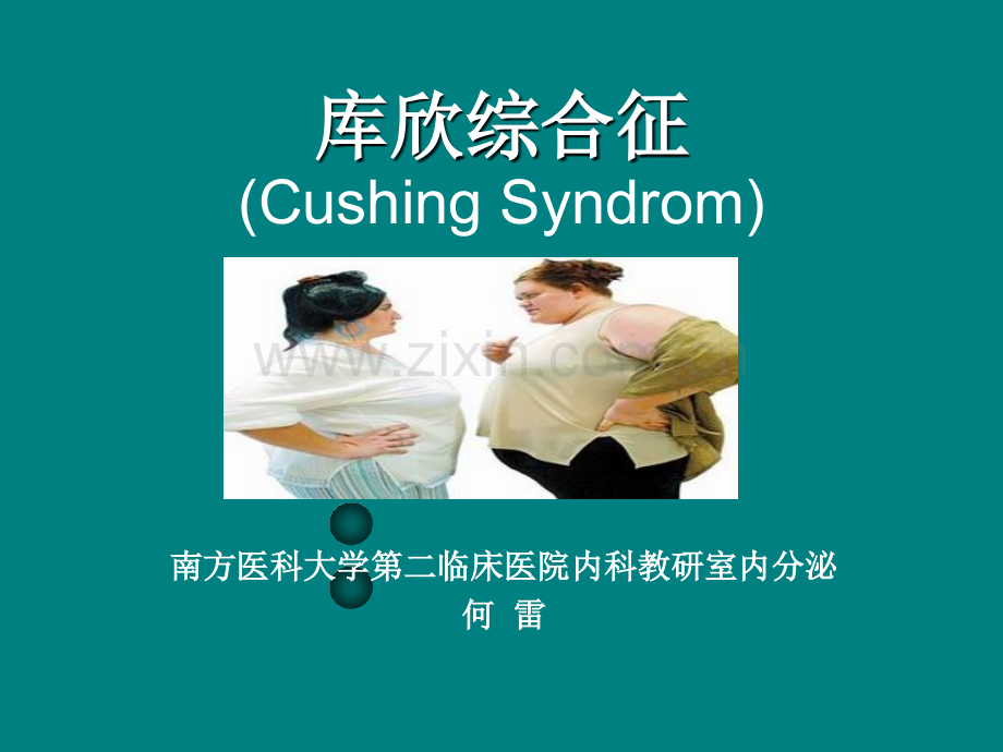 库欣综合征-.ppt_第1页