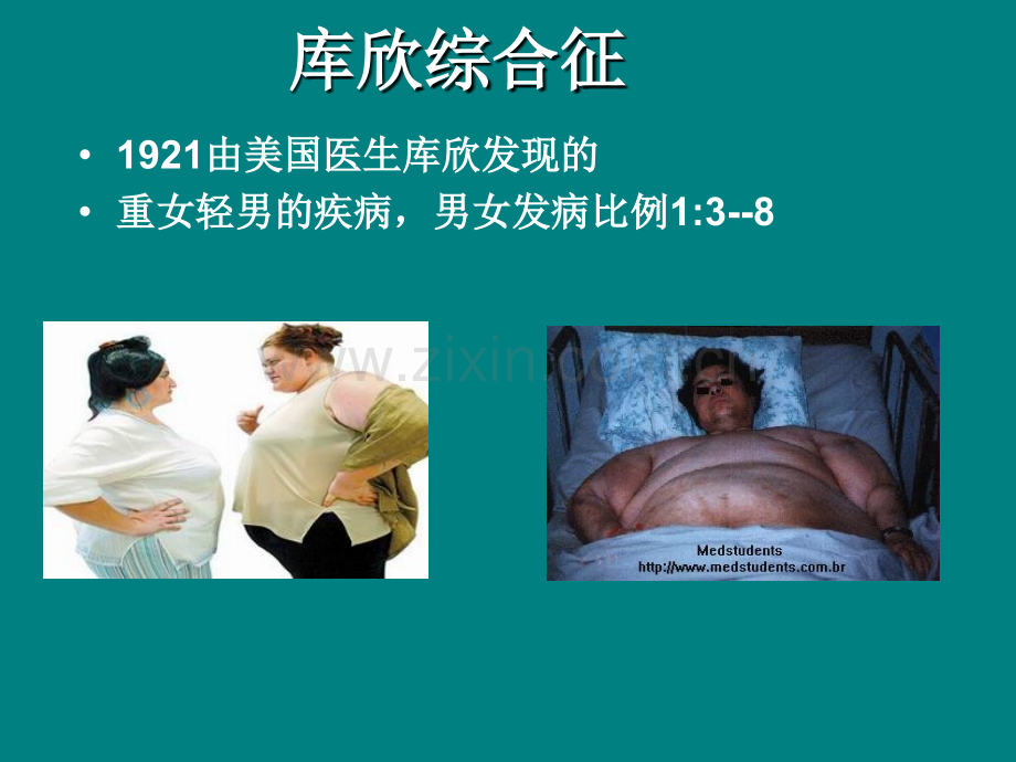 库欣综合征-.ppt_第2页