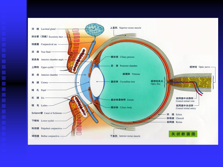 玻璃体病-视网膜病.ppt_第2页