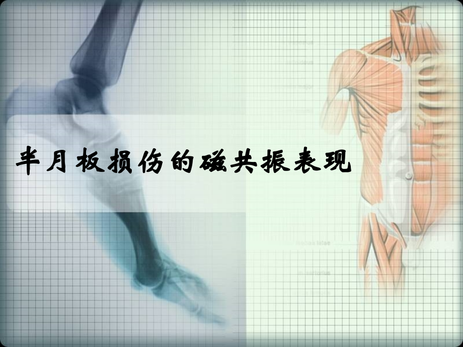 半月板损伤的磁共振表现.ppt_第1页