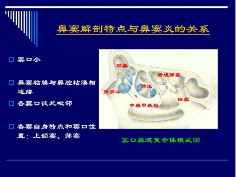 鼻和鼻窦CT解剖.ppt_第2页