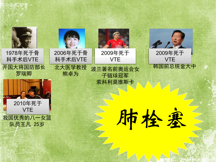 下腔静脉滤器的选择介绍.ppt_第2页