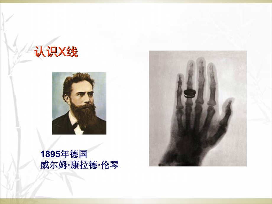 骨科读片基础.ppt_第2页
