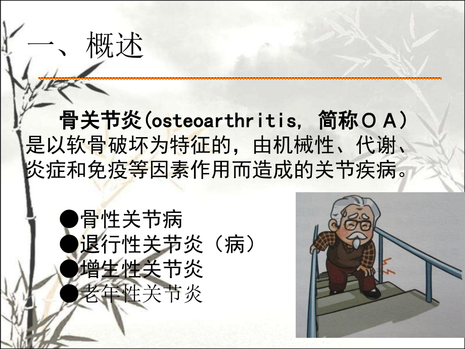 骨关节炎课件.ppt_第2页