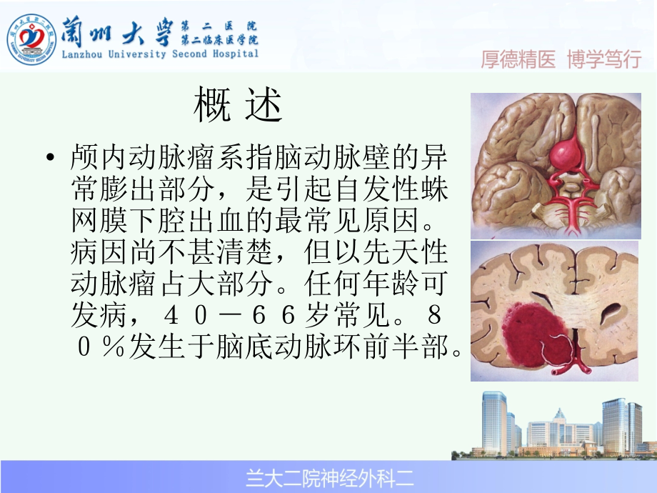 颅内动脉瘤护理课件[1]课件.ppt_第2页