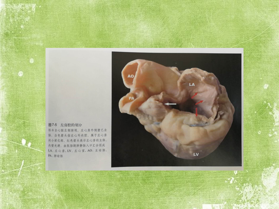 心脏三维解剖分析(左心).ppt_第2页
