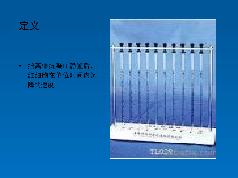 解读血沉.ppt_第2页