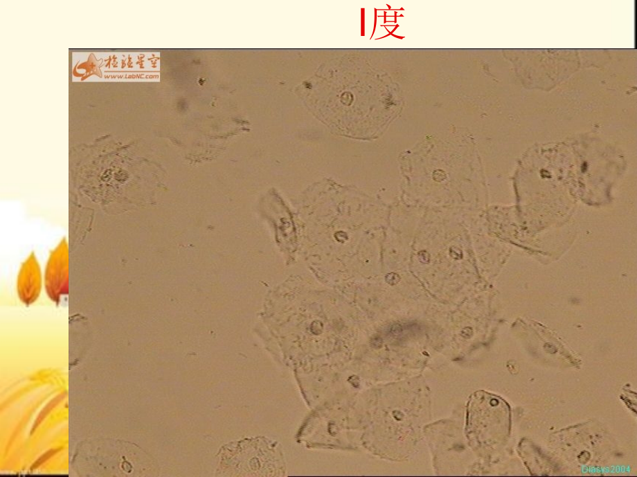 白带盐水涂片镜下图谱.ppt_第2页