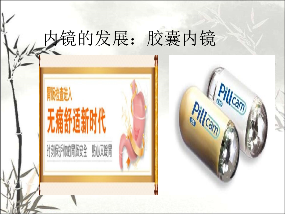 胶囊内镜.ppt_第2页