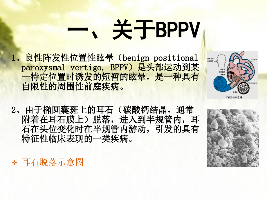 BPPV及难治性BPPV的诊治.ppt_第2页