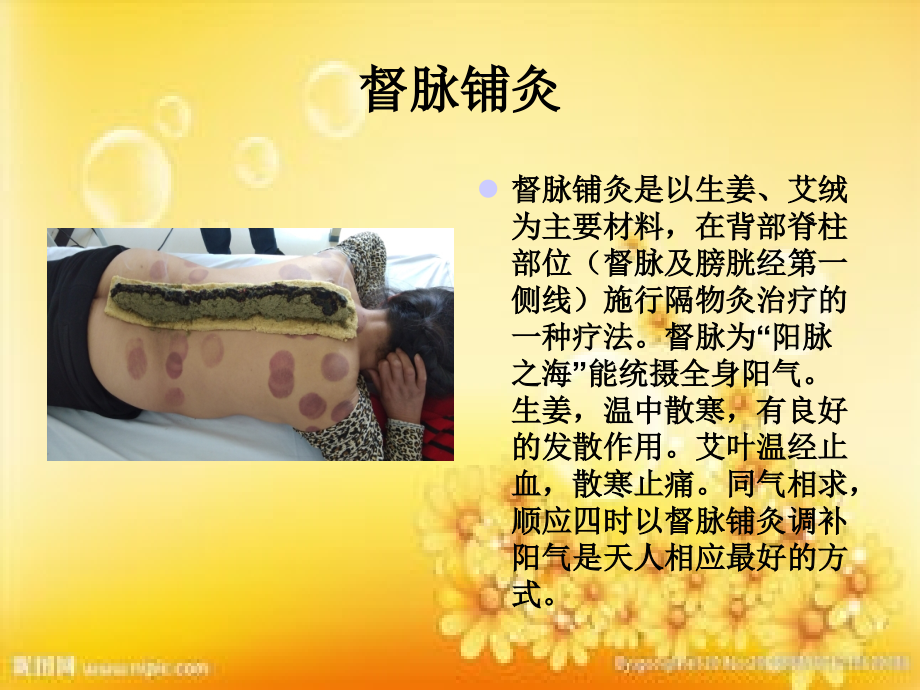 全院中医特色疗法.ppt_第2页